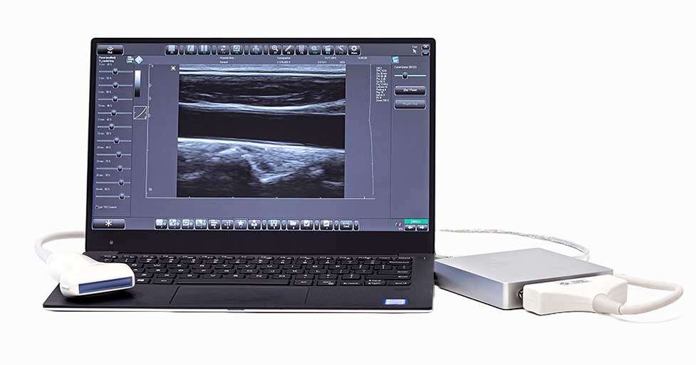 micrus ext scanner